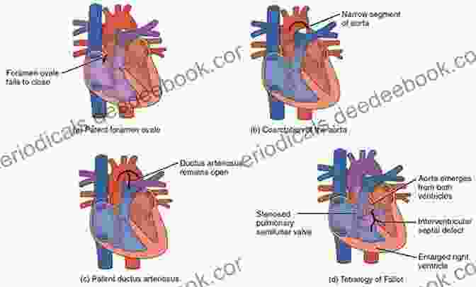 Adolescence Development Diagram Cardiac Catheterization For Congenital Heart Disease: From Fetal Life To Adulthood