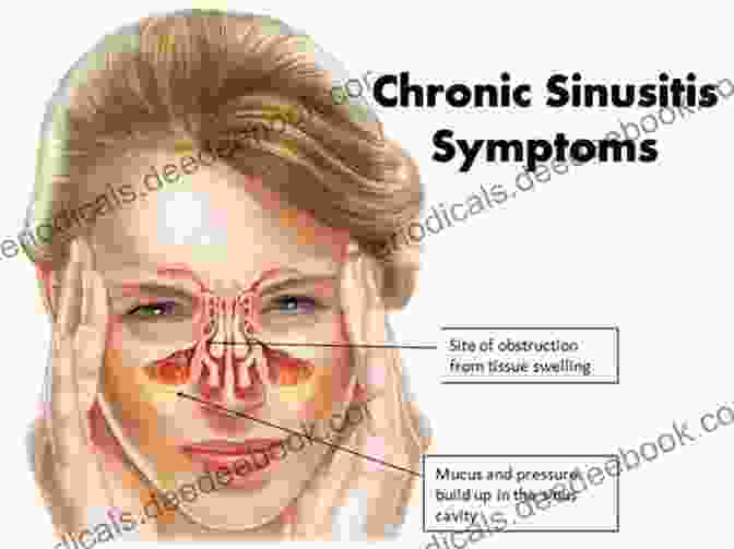 Image Of Sinusitis Showing A Person With Facial Pain Diagnosis In Otorhinolaryngology: An Illustrated Guide