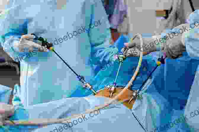 Laparoscopic Surgery For Colorectal Conditions Recent Advances In Coloproctology Adolph Barr