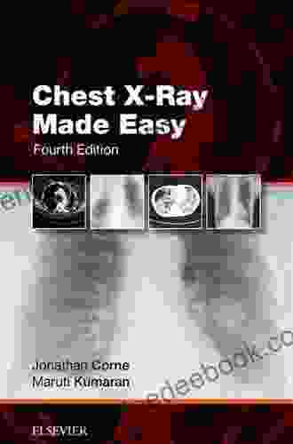 Chest X Ray Made Easy Adolph Barr